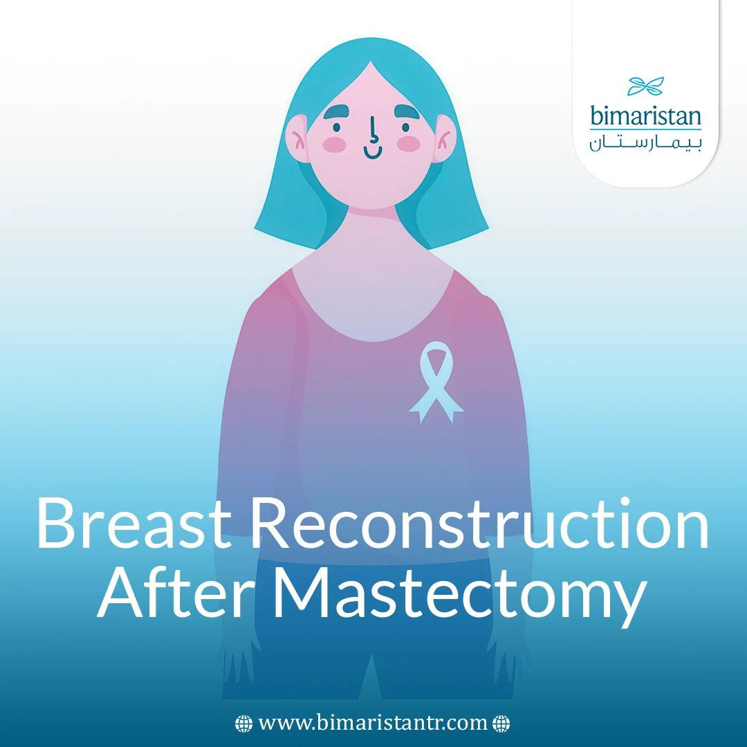 Breast Reconstruction After Mastectomy: A Journey Of Hope