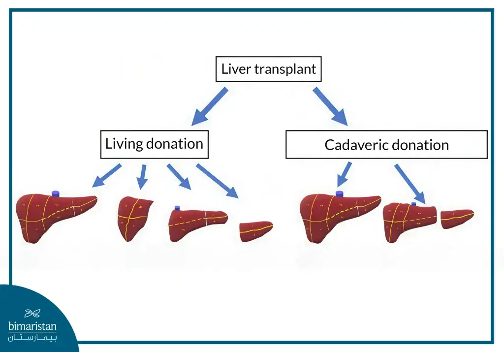 The Difference Between A Living Donor And A Deceased Donor Liver Transplant