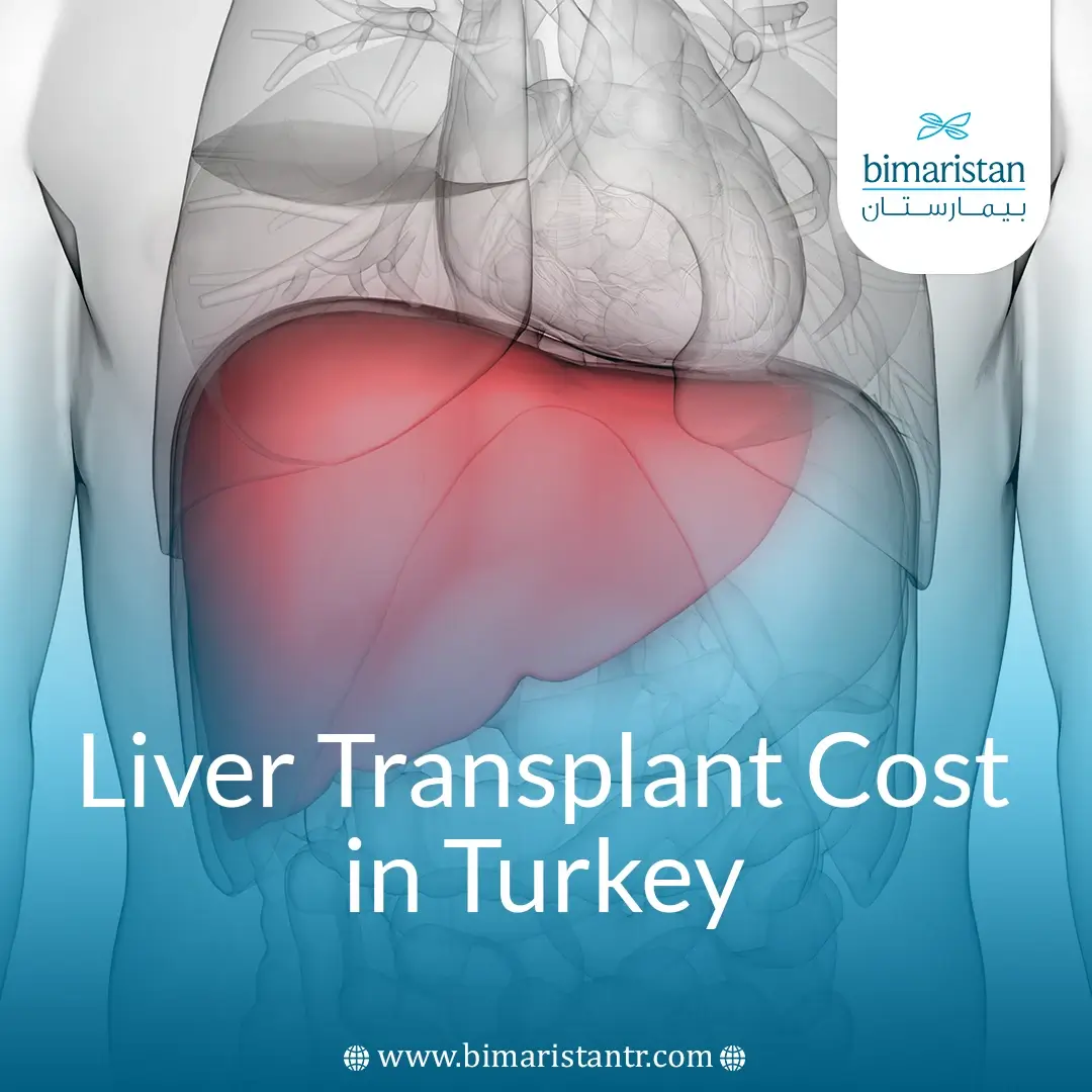 Liver Transplant Cost in Turkey 2025 - Bimaristan