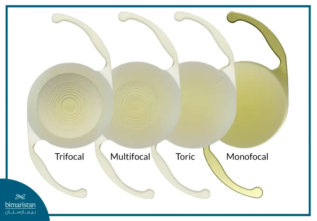 Lens Implantation Cost In Turkey: 2025 Guide To Prices &Amp; Features 2 Types Of Lenses Used In Lens Implants Vary Depending On The Patient'S Condition, Preferences, And Budget, All Of Which Can Affect The Lens Implantation Cost In Turkey.