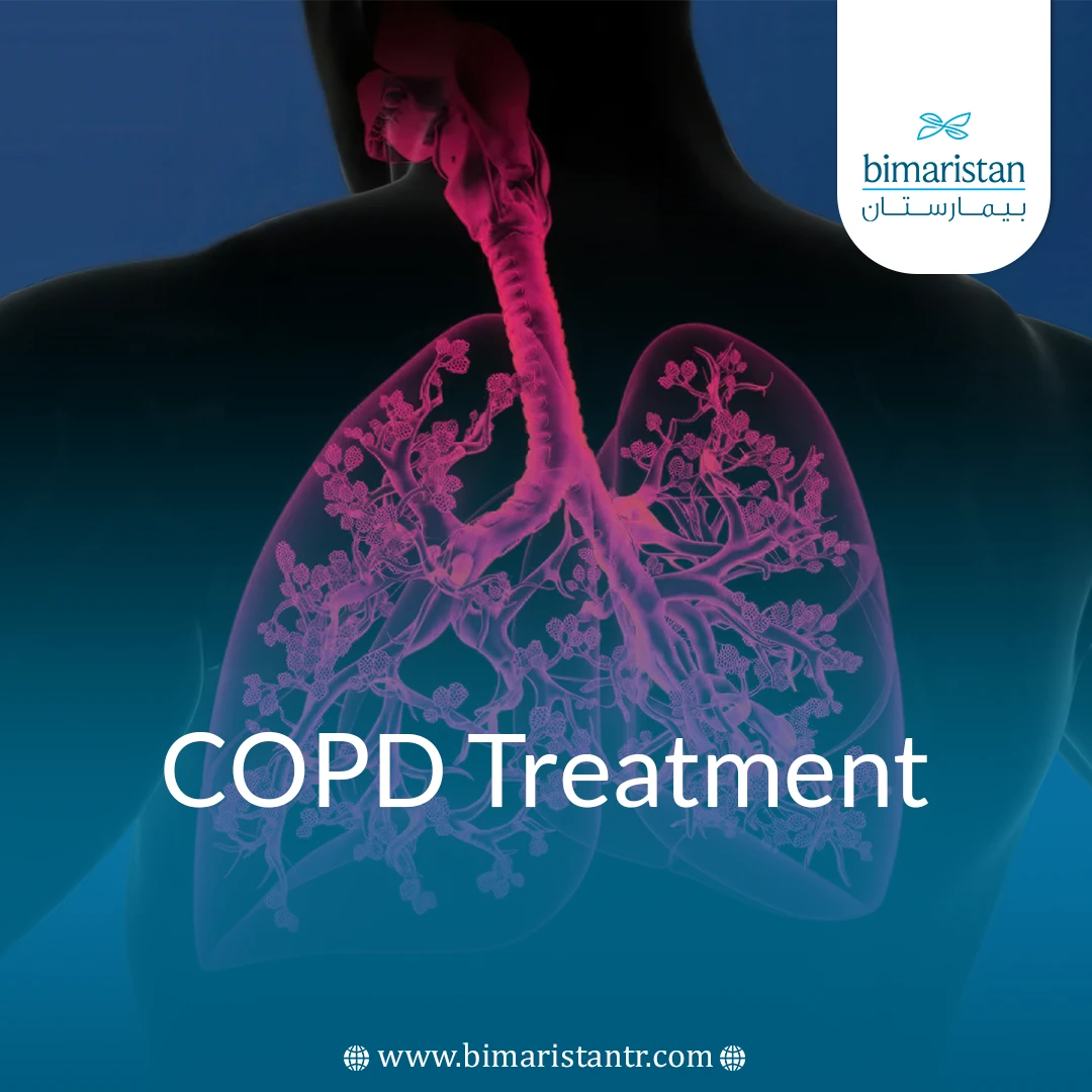 COPD Treatment: Effective Steps for Easy Breathing