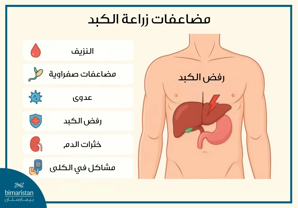 صورة توضح أهم المضاعفات بعد عملية زراعة الكبد