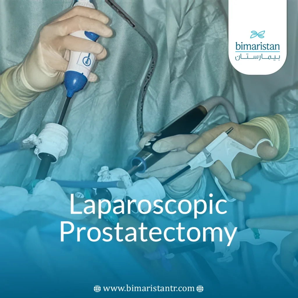 Laparoscopic Prostatectomy