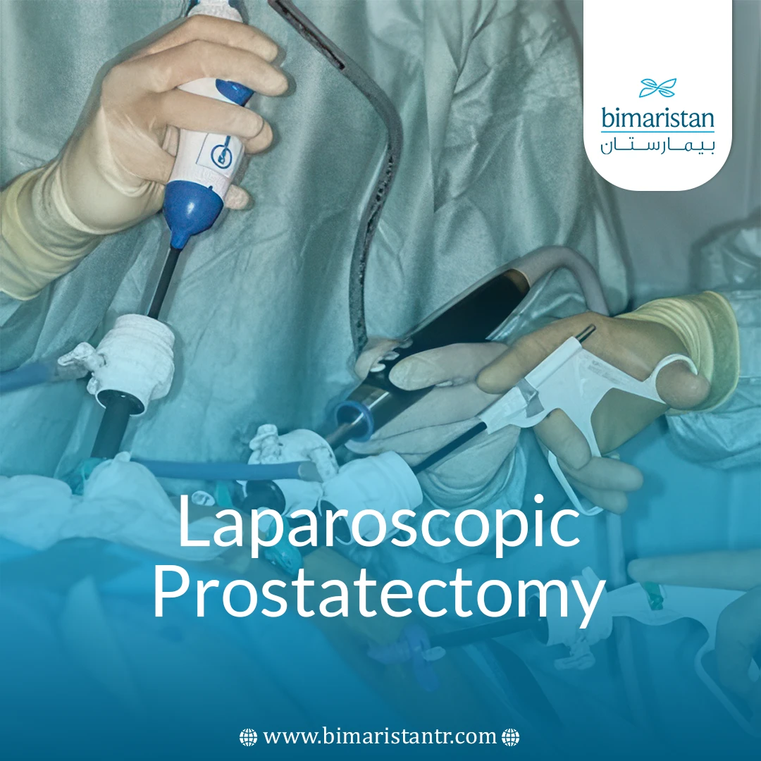 Laparoscopic Prostatectomy: Procedure, Benefits, And Recovery Explained