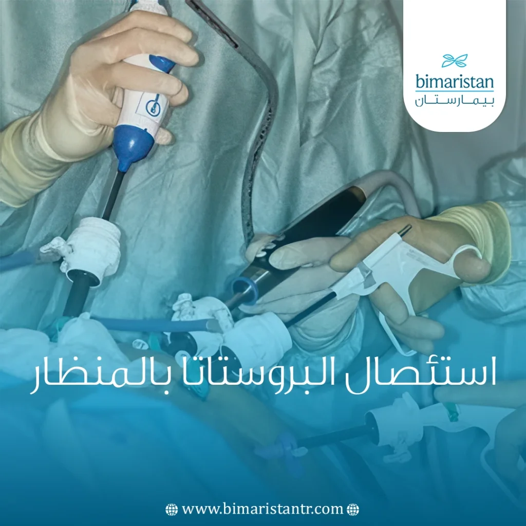 استئصال البروستاتا بالمنظار