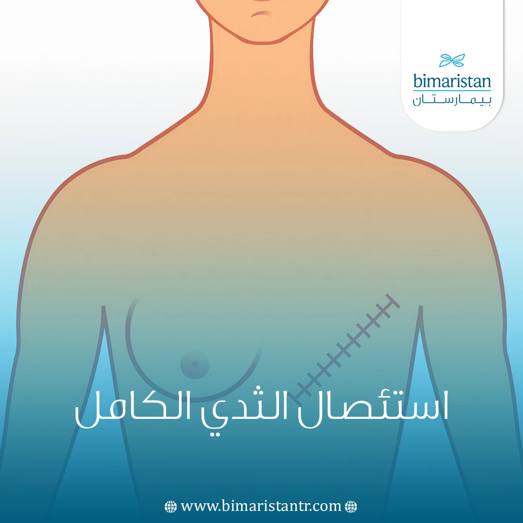استئصال الثدي الكامل