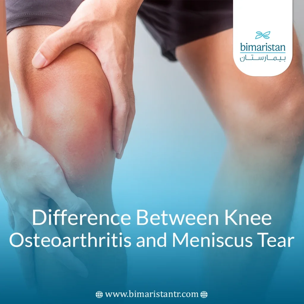 Knee Osteoarthritis Vs Meniscus Tear: Key Pain Differences