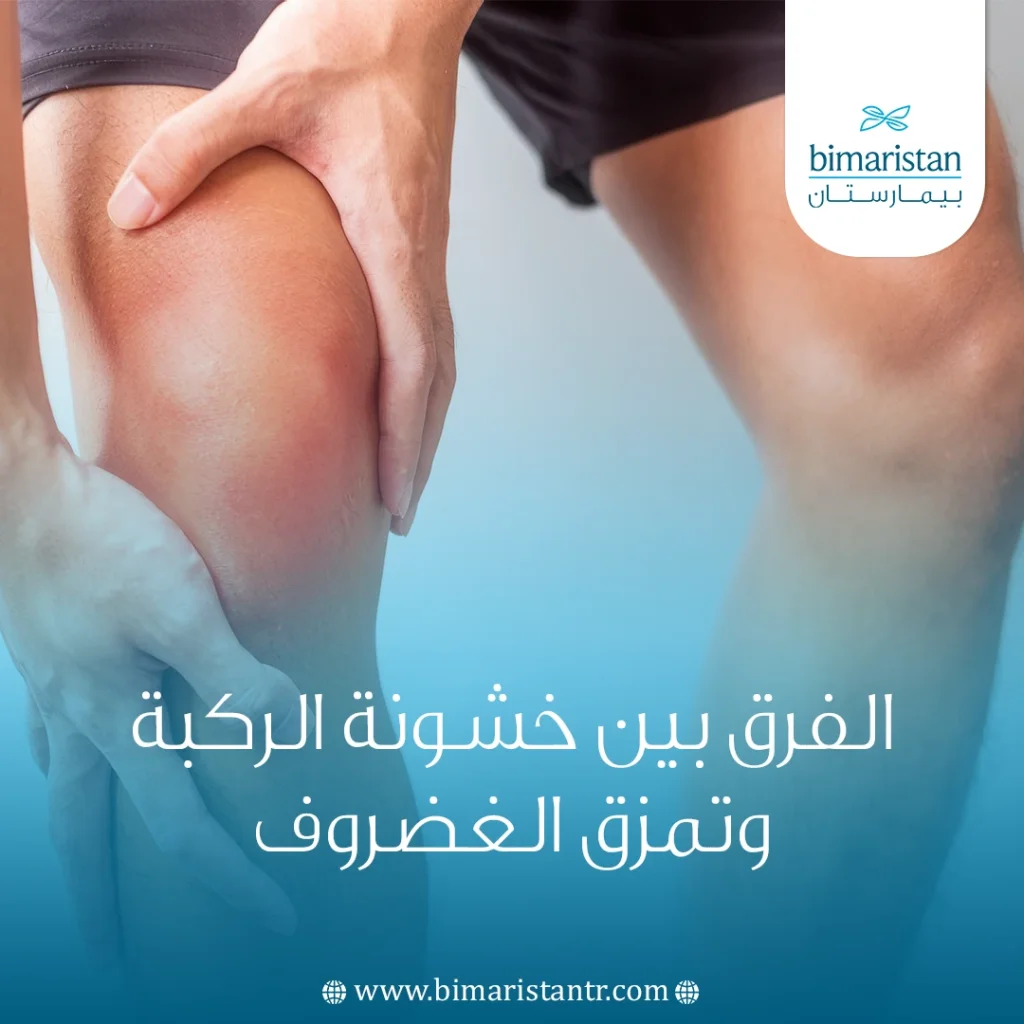 الفرق بين خشونة الركبة وتمزق الغضروف