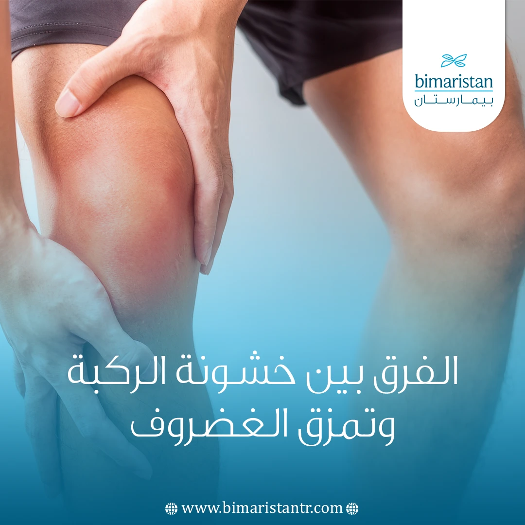 الفرق بين خشونة الركبة وتمزق الغضروف