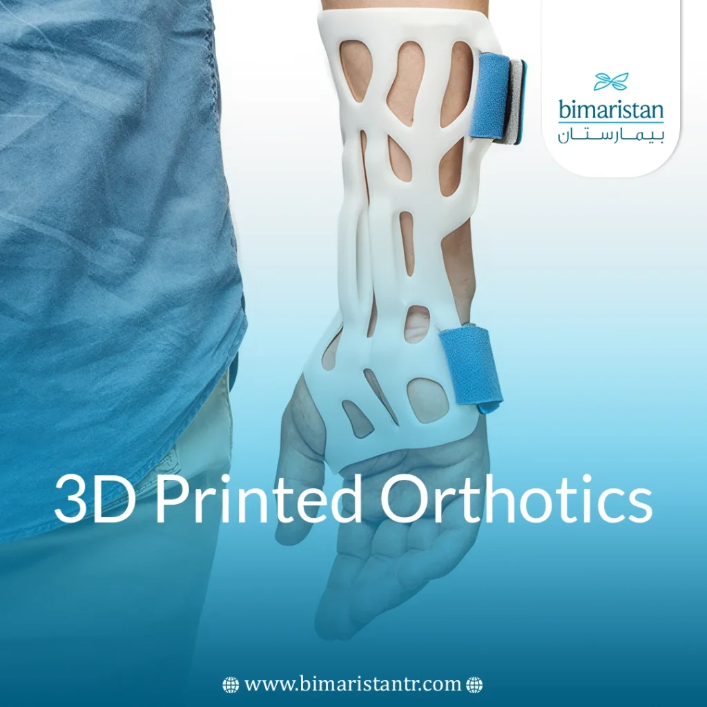 3D Printed Orthotics: Custom Comfort For Every Step