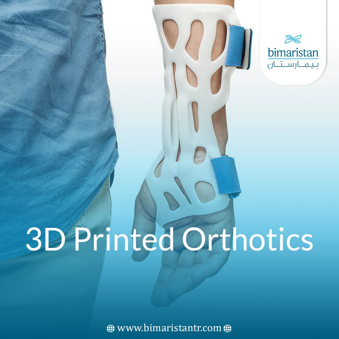 3D Printed Orthotics: Custom Comfort For Every Step
