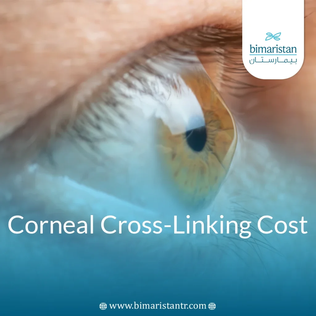 Corneal Cross-Linking Cost In Turkey: Prices &Amp; Treatment