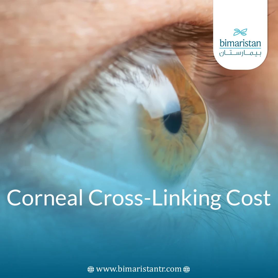 Corneal Cross-Linking Cost In Turkey: Affordable Prices And Advanced Treatment Options