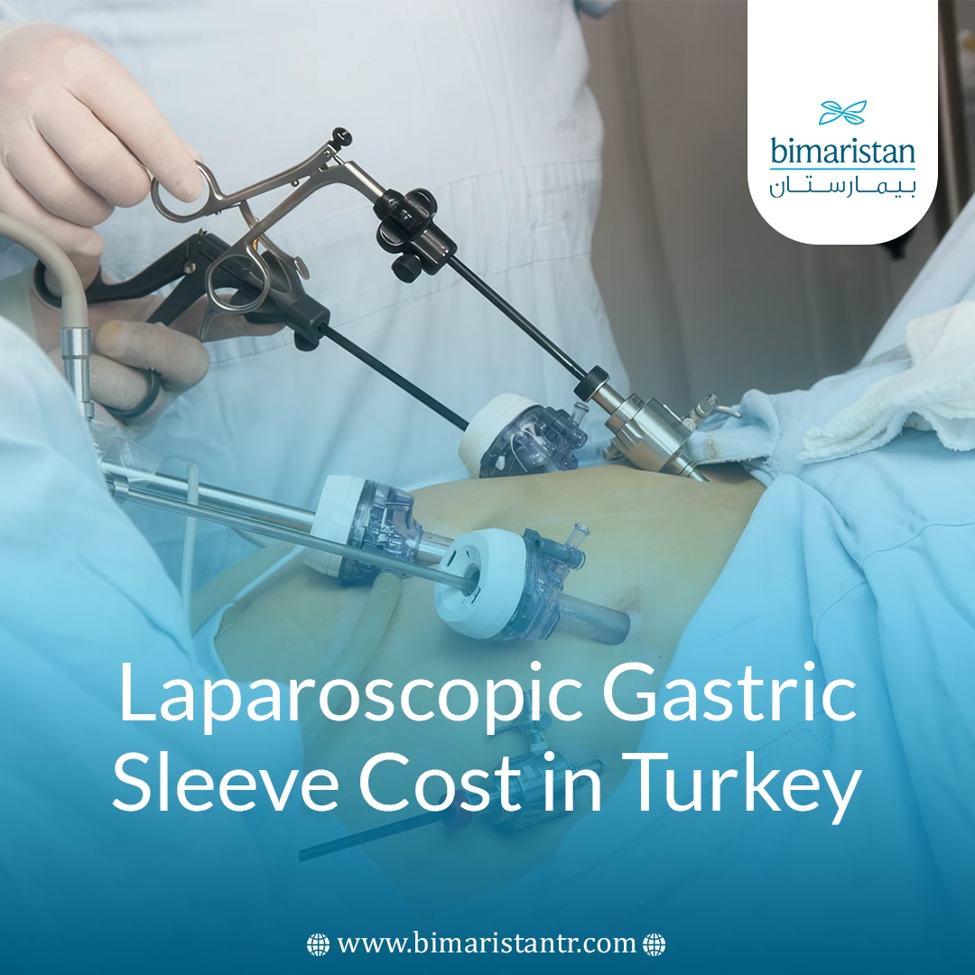 Laparoscopic Gastric Sleeve Cost In Turkey: Comprehensive Guide To Prices And Features