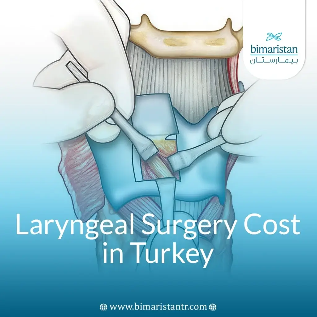 Laryngeal Surgery Cost In Turkey: Factors And Best Options