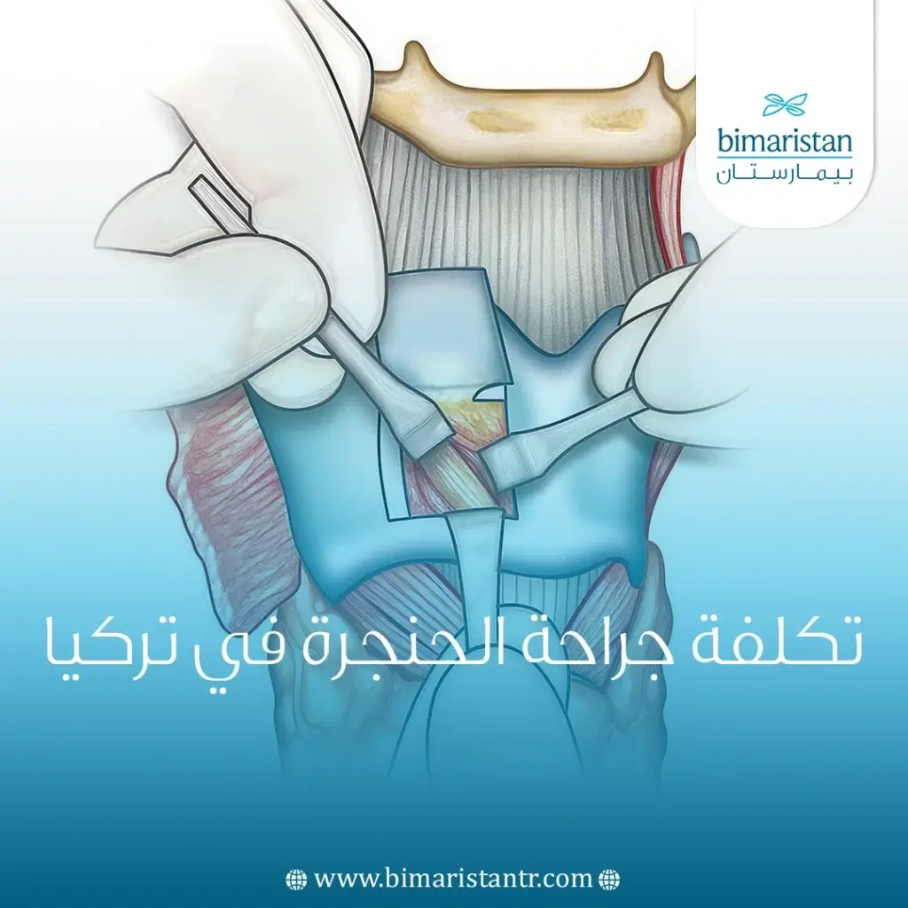 تكلفة جراحة الحنجرة في تركيا