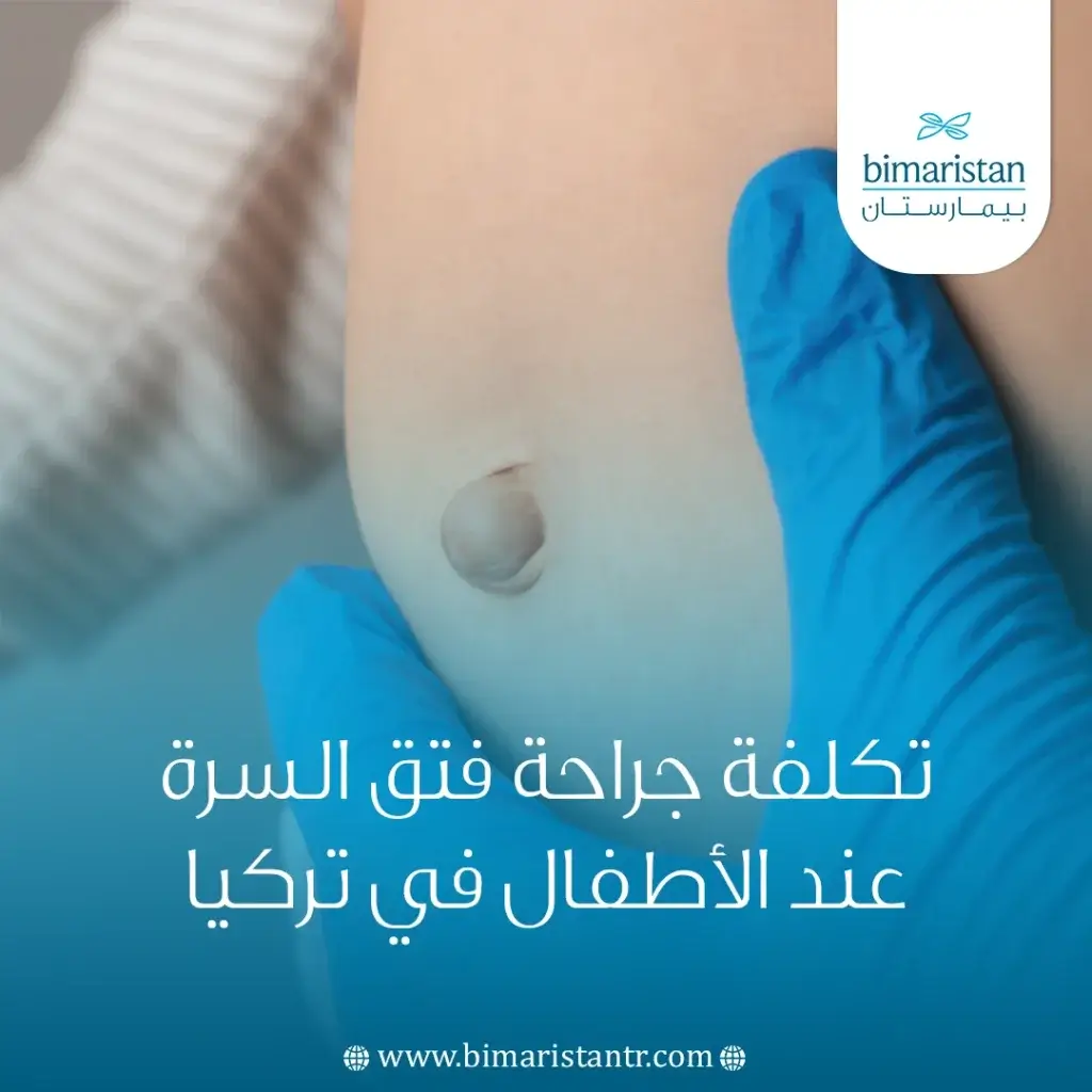 تكلفة جراحة فتق السرة عند الأطفال في تركيا