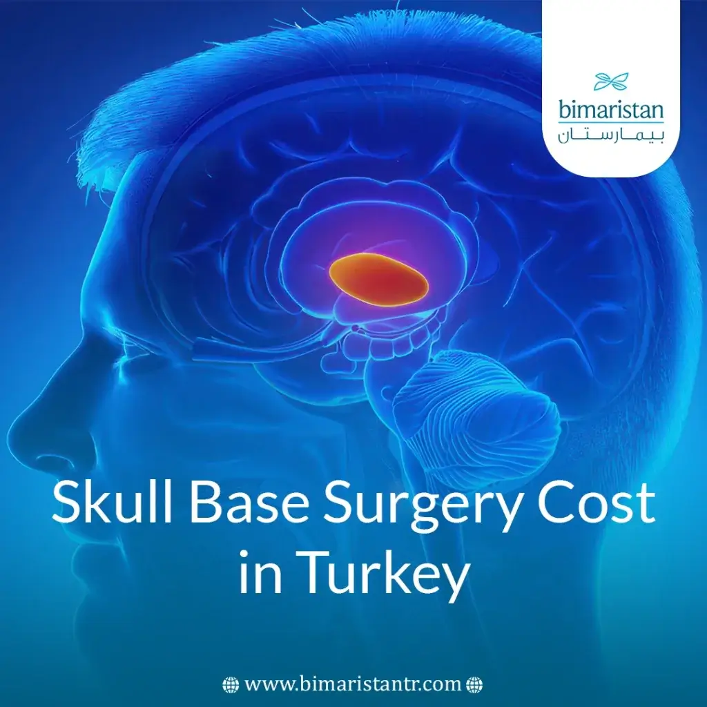 Skull Base Surgery Cost In Turkey: Key Facts To Know