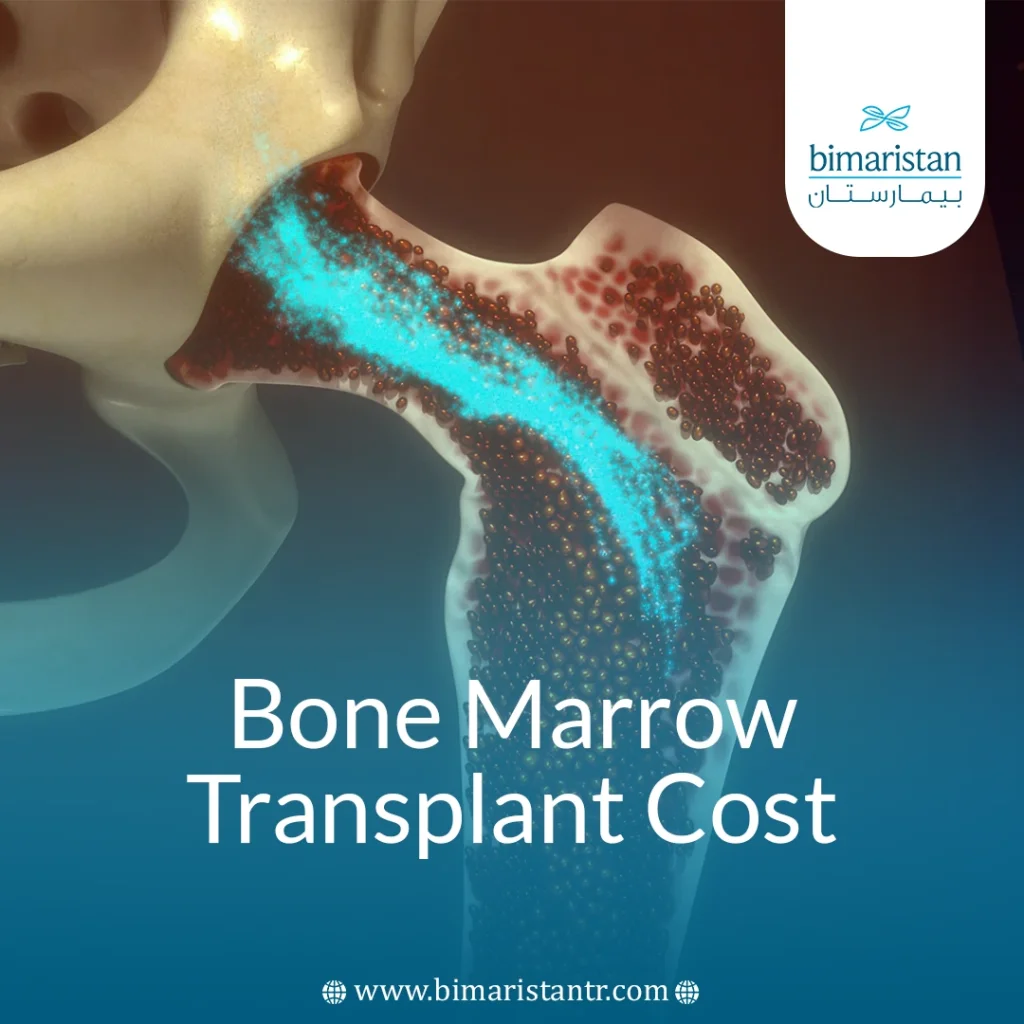 Bone Marrow Transplant Cost
