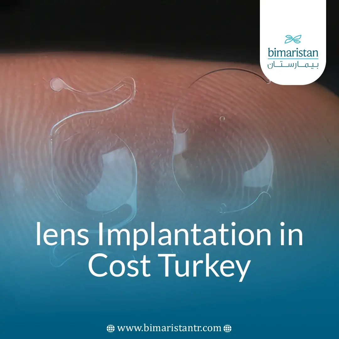 Lens Implantation Cost In Turkey: 2025 Guide To Prices &Amp;Amp; Features