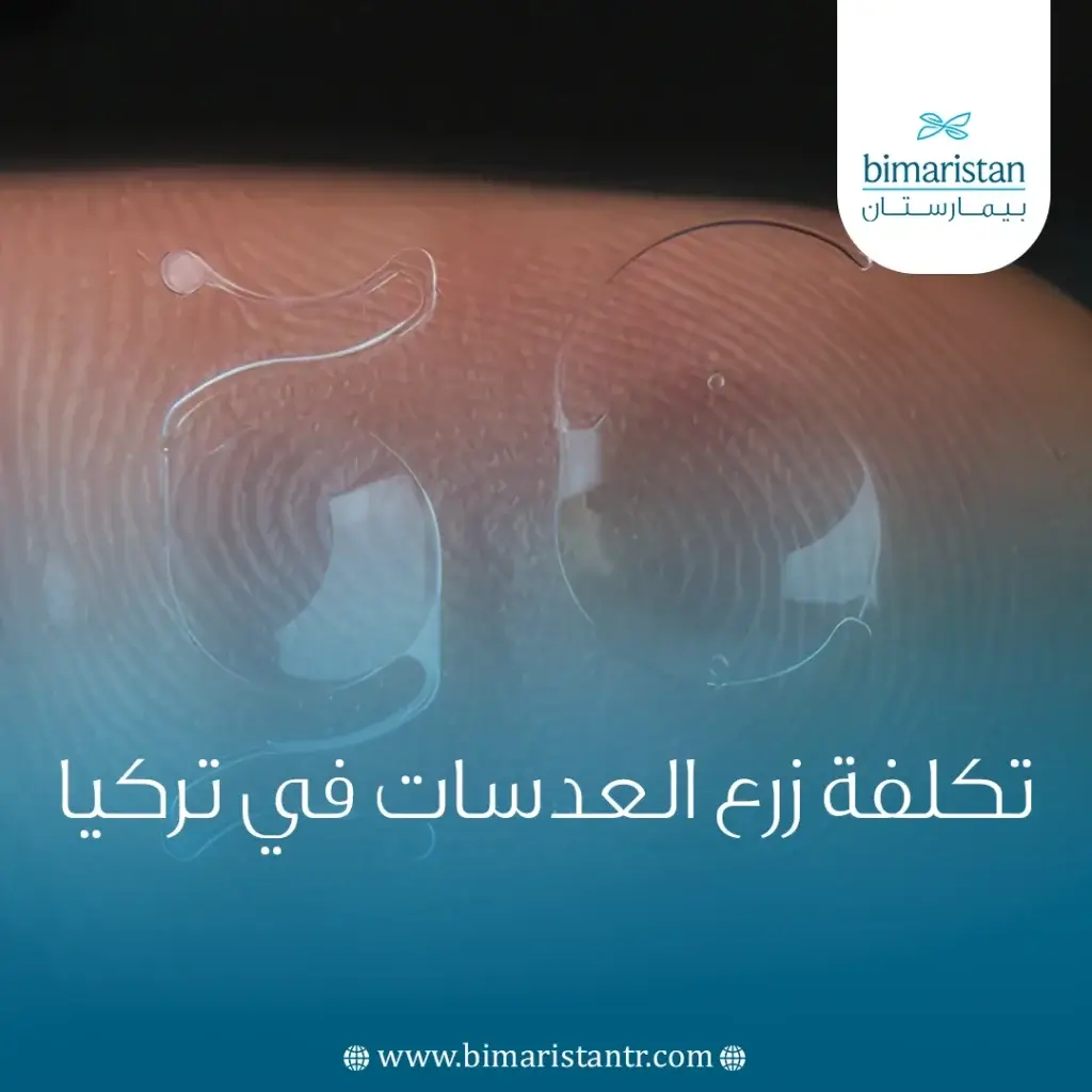 تكلفة زرع العدسات في تركيا