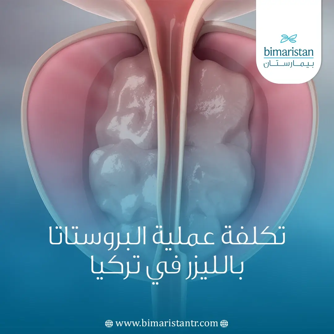تكلفة عملية البروستاتا بالليزر في تركيا