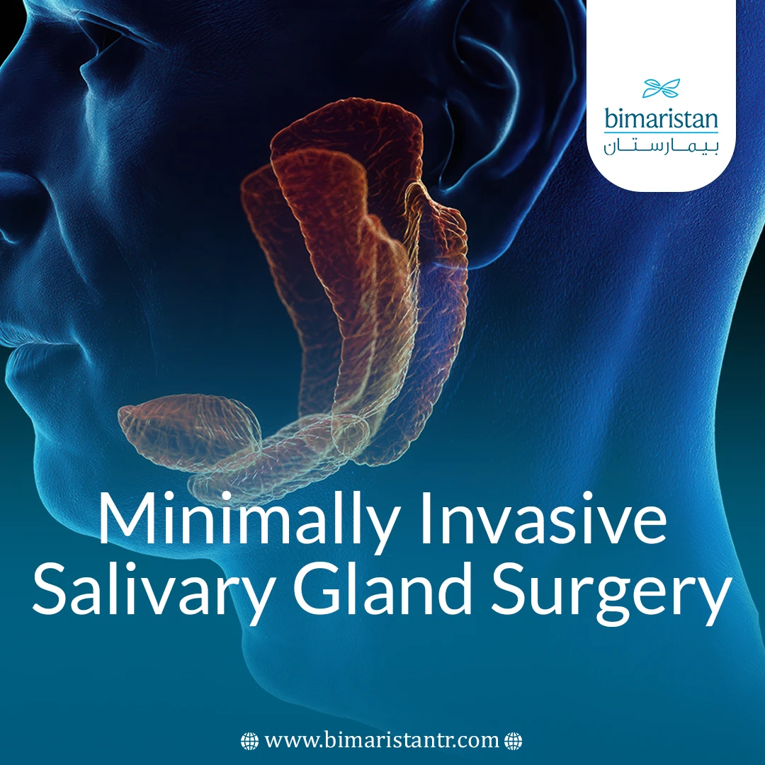 Minimally Invasive Salivary Gland Surgery: Indications And Main Techniques