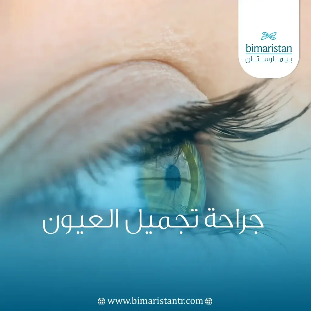 جراحة تجميل العيون