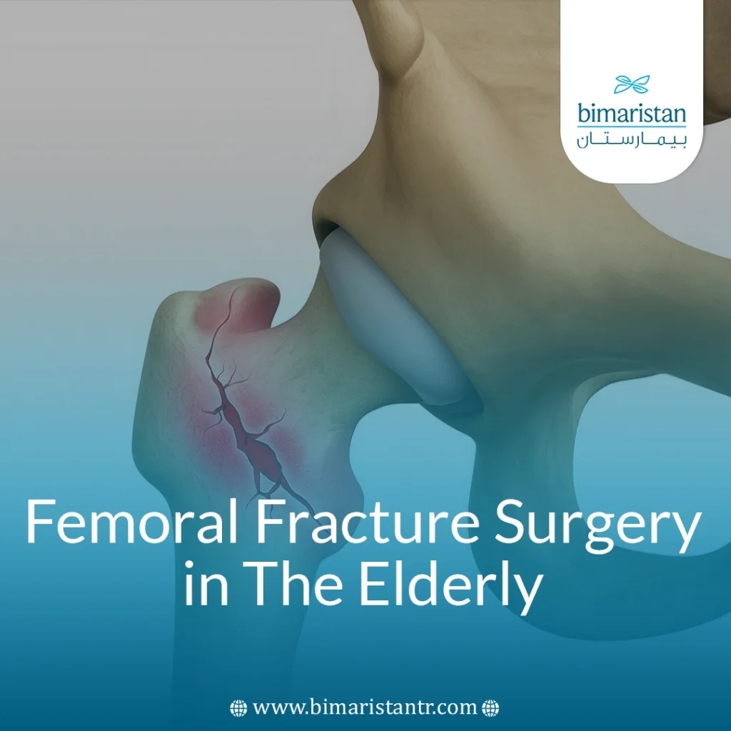 Femoral Fracture Surgery In The Elderly: Key Facts 2025
