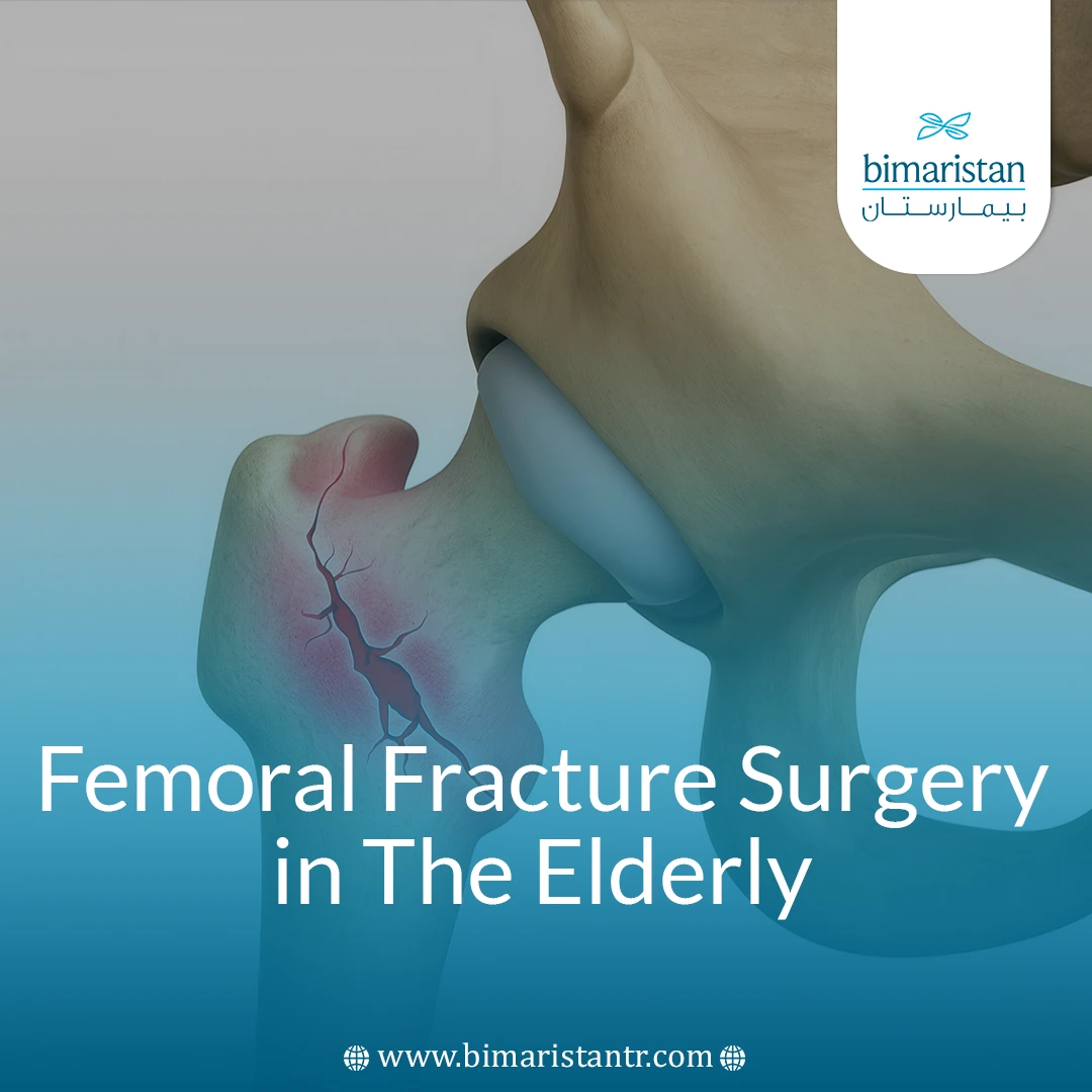 Femoral Fracture Surgery In The Elderly: Key Facts 2025