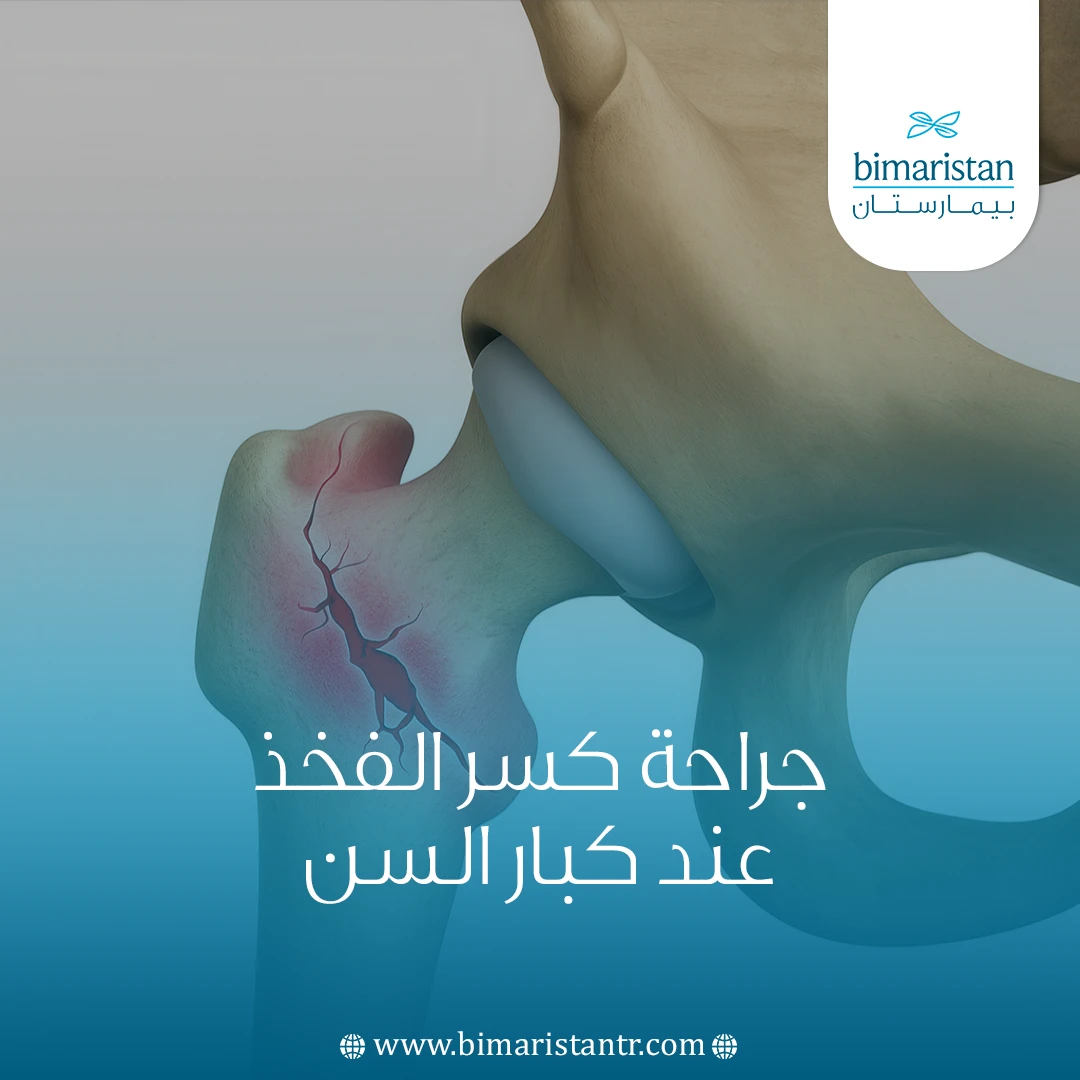جراحة كسر الفخذ عند كبار السن