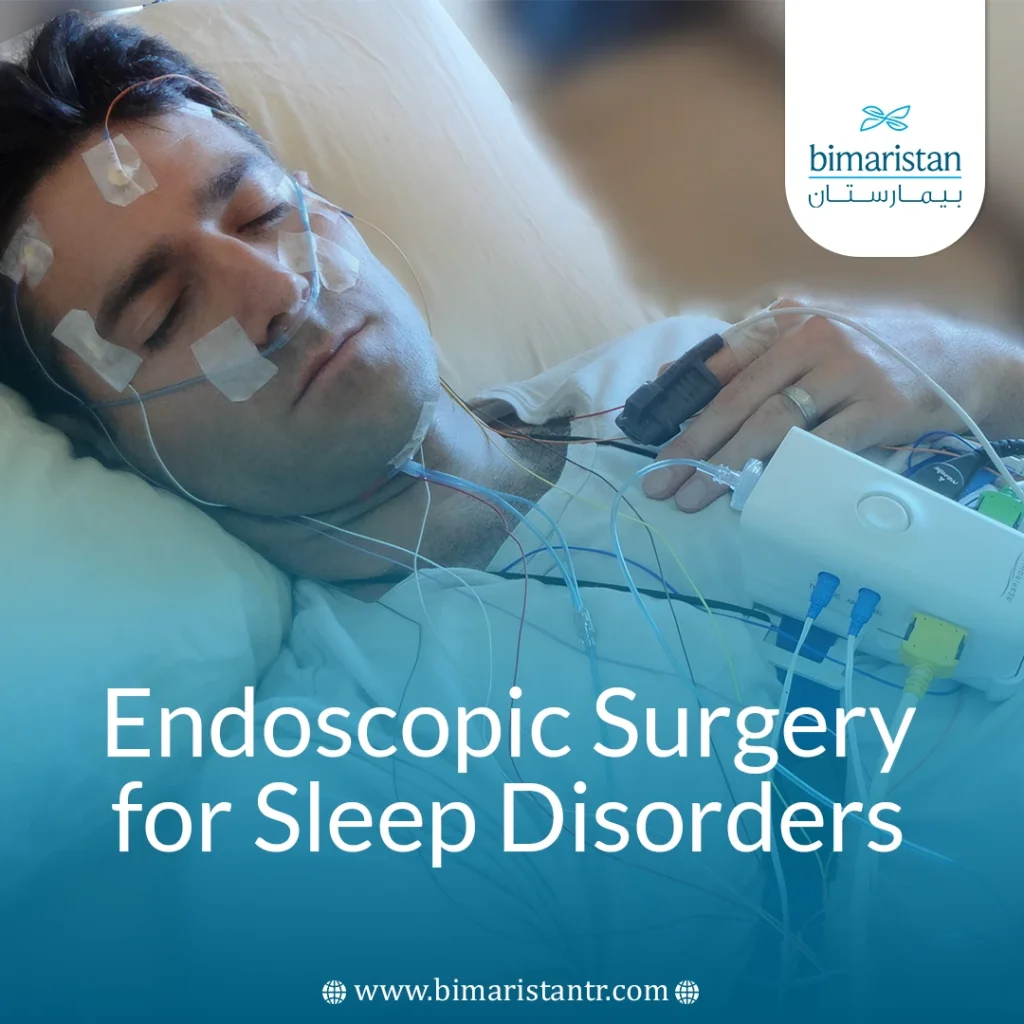 Endoscopic Surgery For Sleep Disorders: Effective Solution