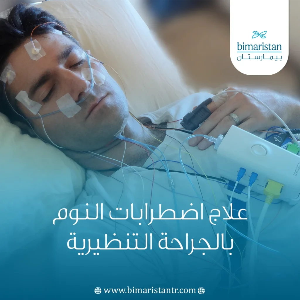 علاج اضطرابات النوم بالجراحة التنظيرية