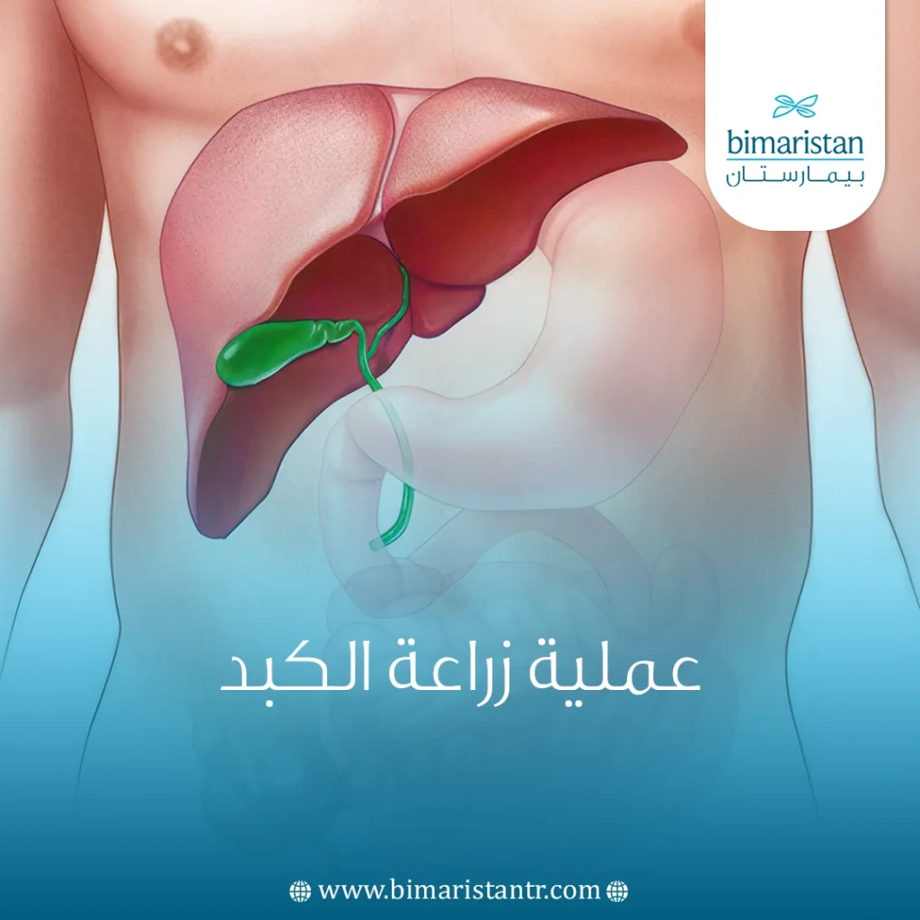 عملية زراعة الكبد