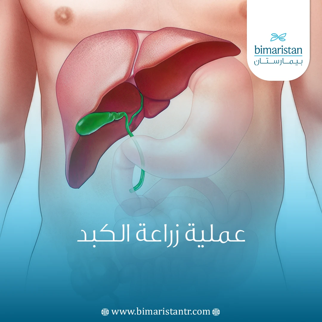 عملية زراعة الكبد