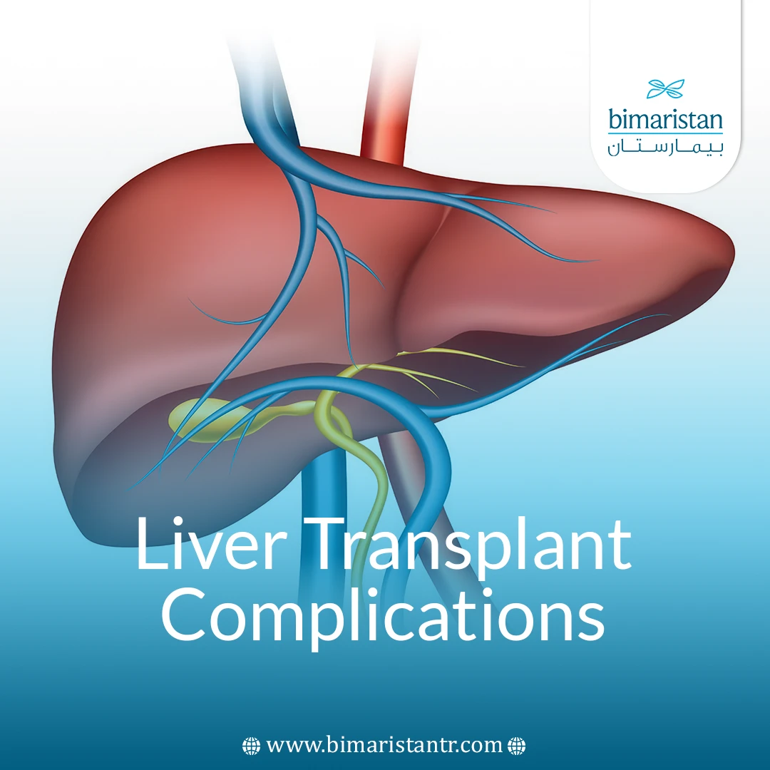 Liver Transplant Complications