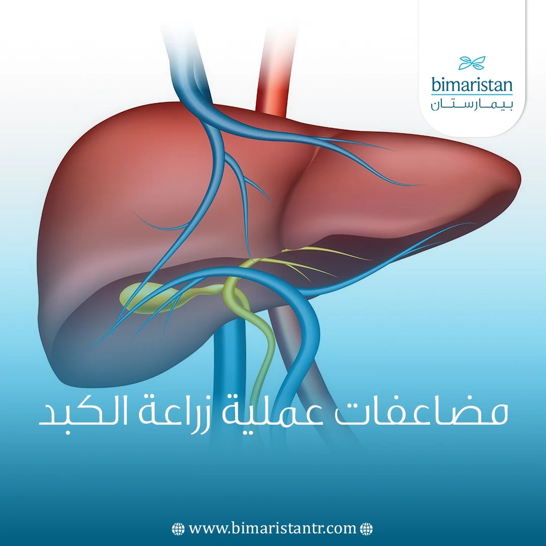 مضاعفات عملية زراعة الكبد