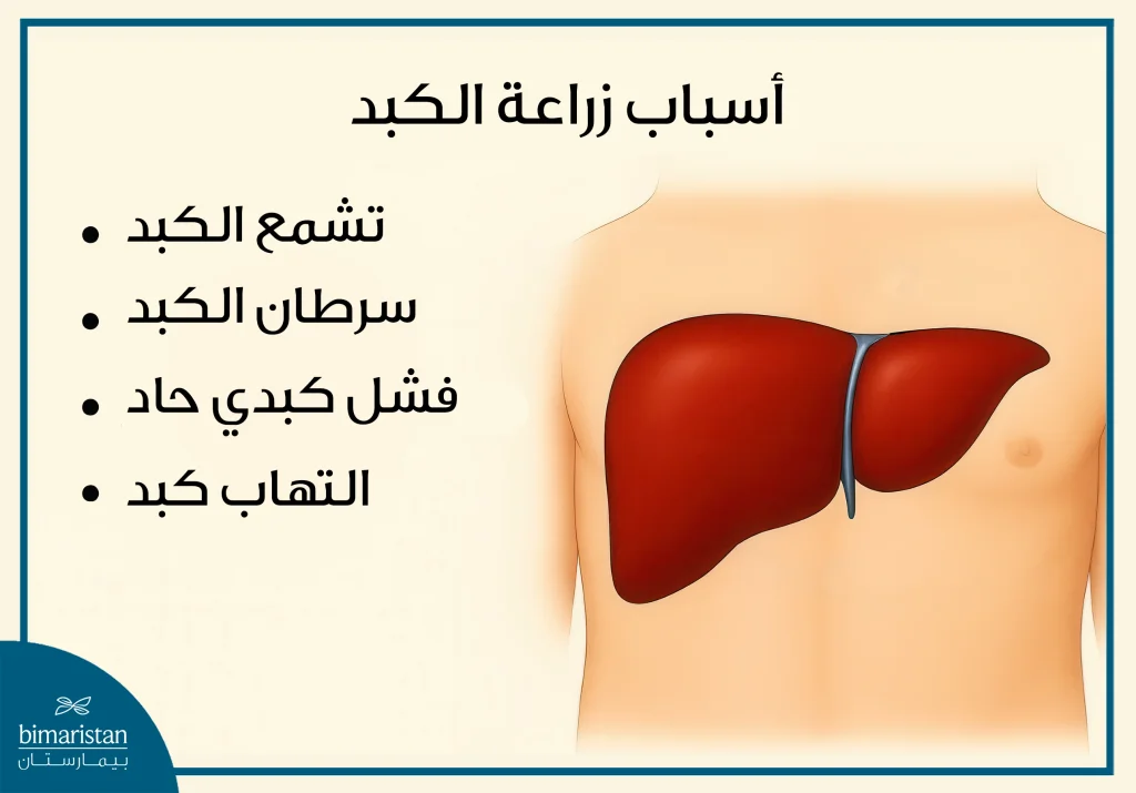 صورة توضح أهم أسباب عملية زراعة الكبد 