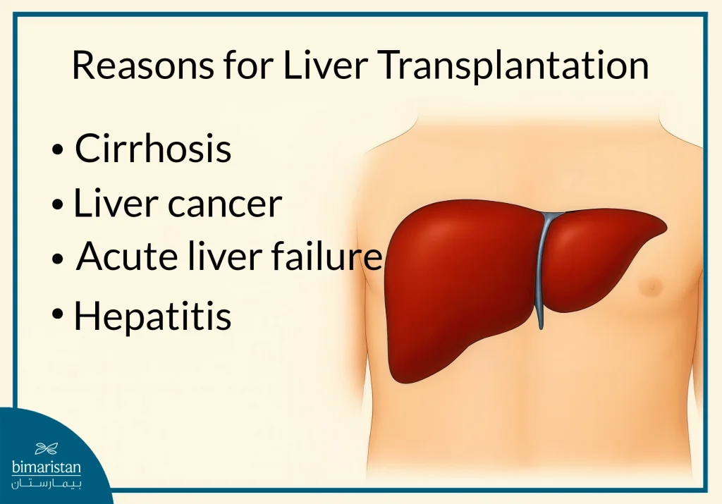 Liver Transplant Reasons And Post-Surgery Rehabilitation: Your Complete 2025 Guide 4 An Image Illustrating The Leading Reasons For Liver Transplant Procedure