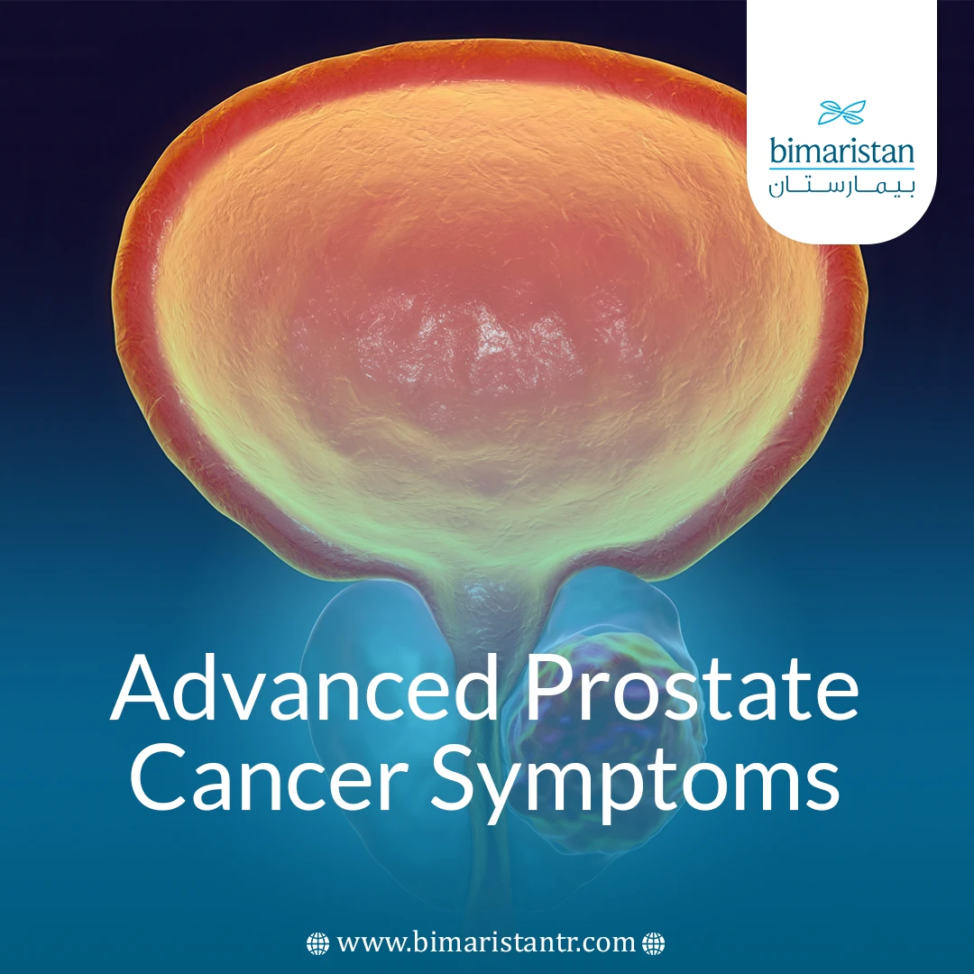 Advanced Prostate Cancer Symptoms