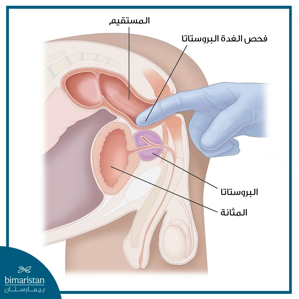 آلية فحص البروستاتا لتشخيص التهاب المسالك البولية