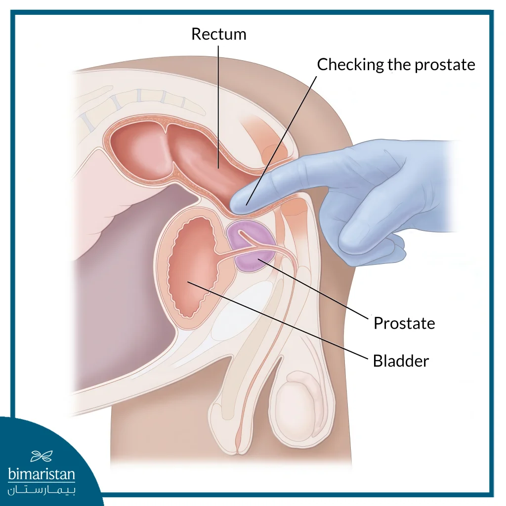 Urinary Tract Infection: A Comprehensive Medical Guide 3 How To Use A Prostate Exam To Diagnose A Urinary Tract Infection