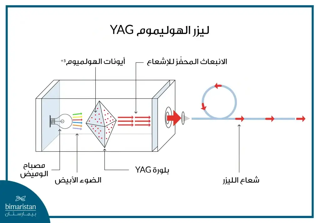 صورة توضح مكونات جهاز ليزر الهولميوم لعلاج الحصيات البولية