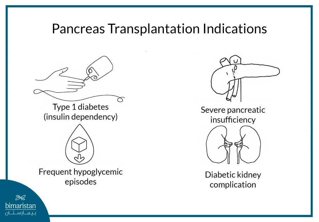 An Image Illustrating The Indications For A Pancreas Transplant