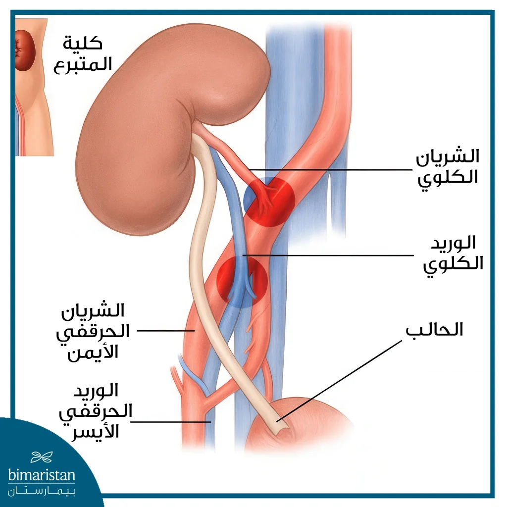 صورة توضح عمليات الربط في عملية زراعة الكلى للأطفال