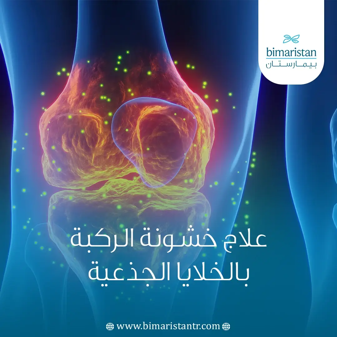 علاج خشونة الركبة بالخلايا الجذعية