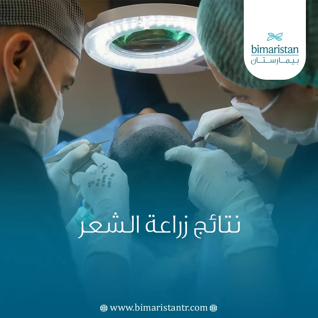 نتائج زراعة الشعر