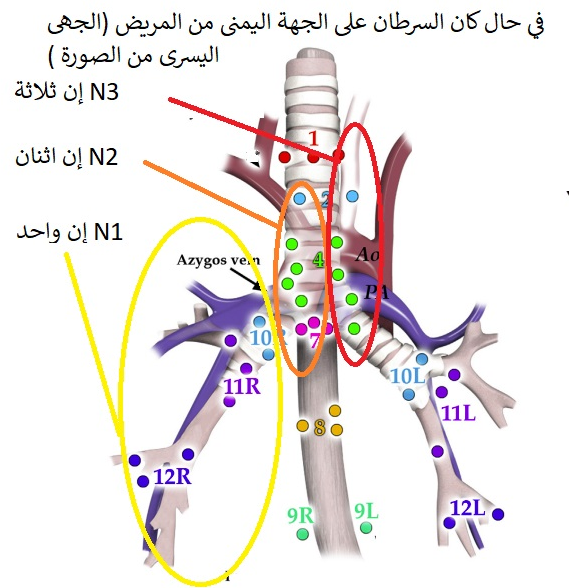 مراحل سرطان الرئة حسب التصنيف التاسع لعام 2025 3 Image 1