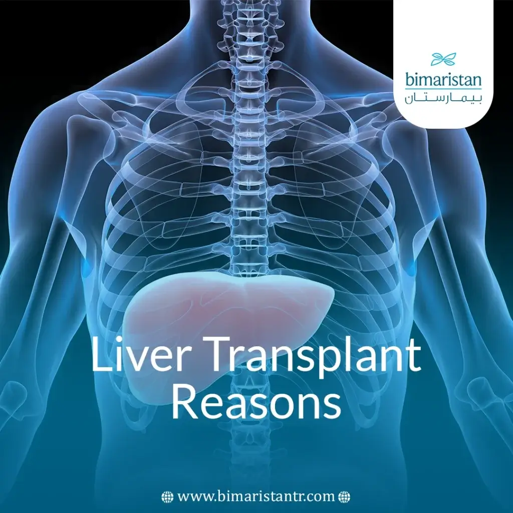 Liver Transplant Reasons And Post-Surgery Rehabilitation: Your Complete 2025 Guide 5 Liver Transplant Reasons