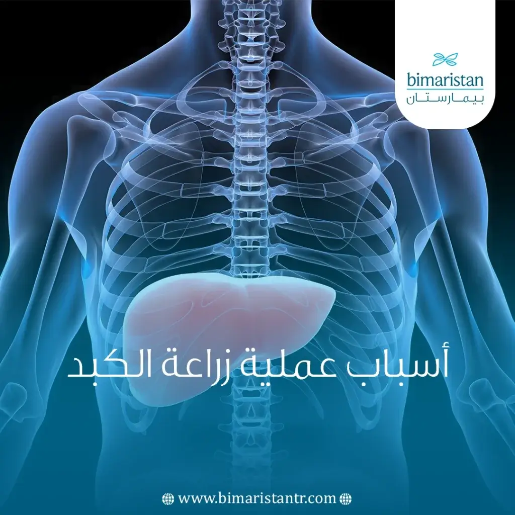 أسباب عملية زراعة الكبد